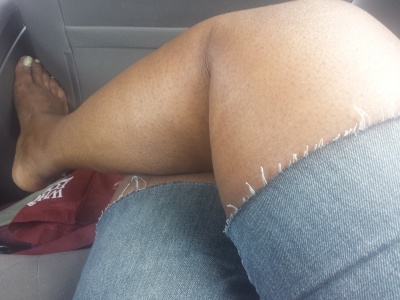 my legs